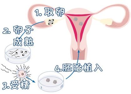 医疗设备